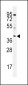 ELMD2 Antibody  (C-term)